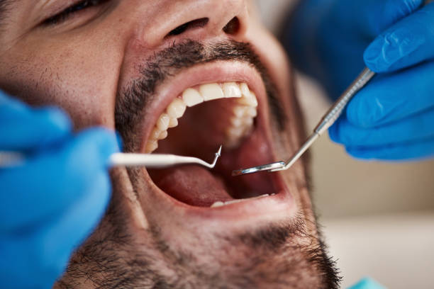 Best Emergency Cosmetic Dentistry (e.g., broken veneers) in Quail Creek, TX